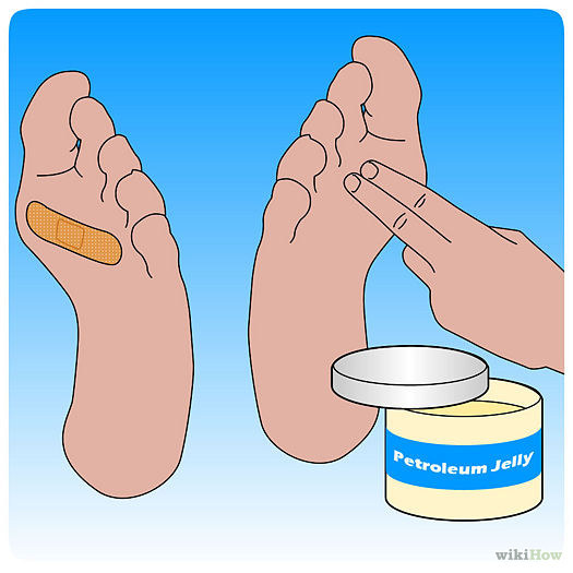 If you're prone to blisters in your hiking boots, coat those areas with petroleum jelly before putting on your socks and boots.