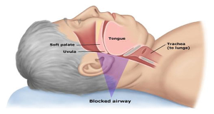 how to stop snoring